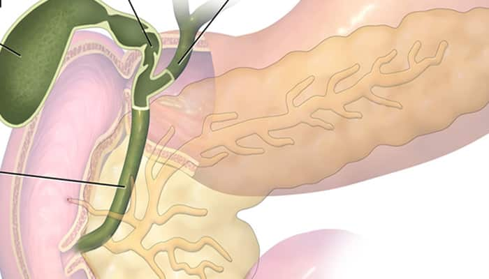 Genetic variants that may predispose individuals to develop gallbladder cancer identified