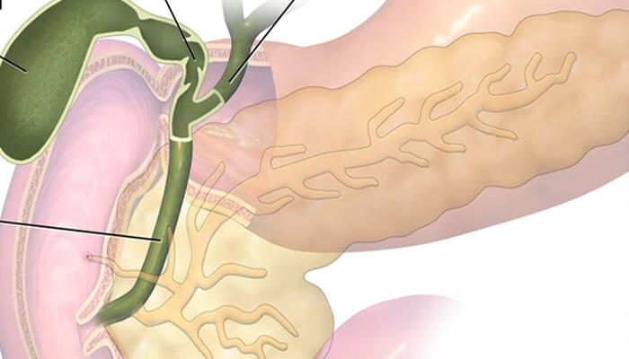 Gallbladder cancer: Know its signs and symptoms!