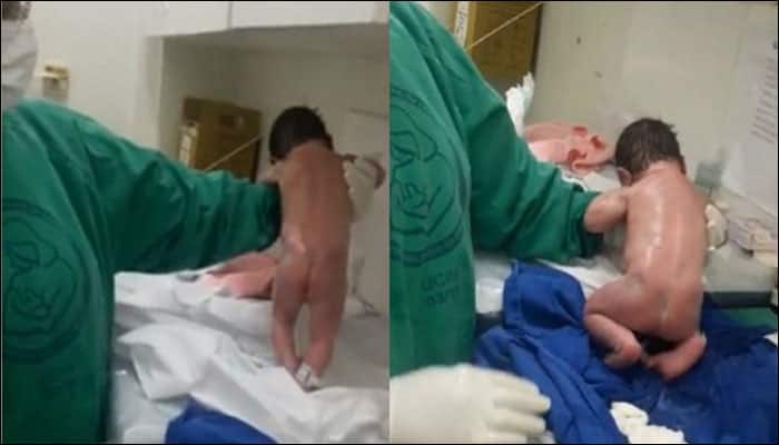 Newborn baby walking immediately after birth has social media in awe! - WATCH VIDEO
