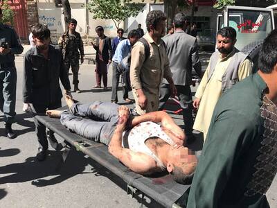 An injured man is being transferred to hospital in Kabul, Afghanistan.