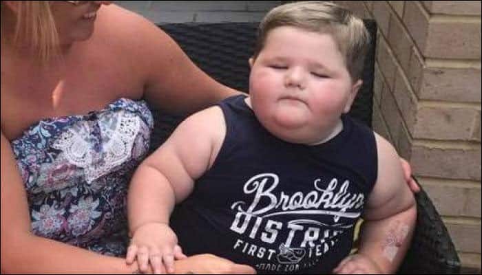 Toddler gains 19 kg in six months after surgery to remove brain tumour – Read his story