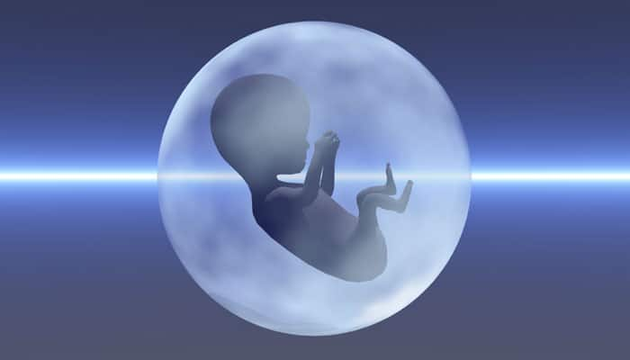 Supreme Court allows plea to abort foetus without skull