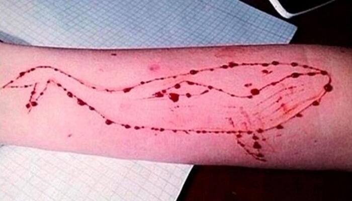 Blue Whale Challenge game claims Pondicherry University student&#039;s life
