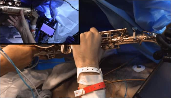 US man plays saxophone while doctors remove brain tumour 