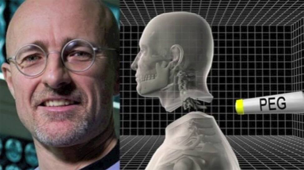 World&#039;s first successful head transplant carried out on corpses, claims scientist