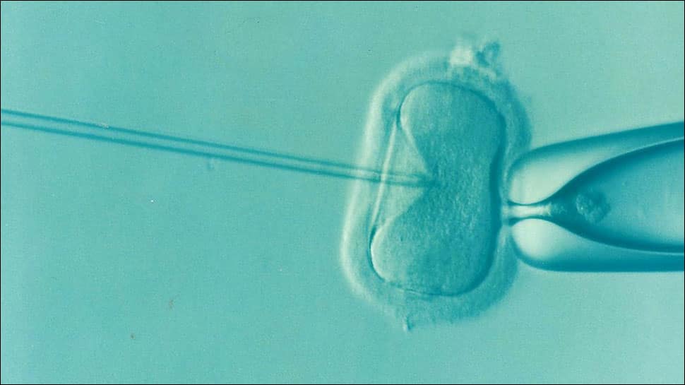 Novel sperm-sorting device could improve IVF success