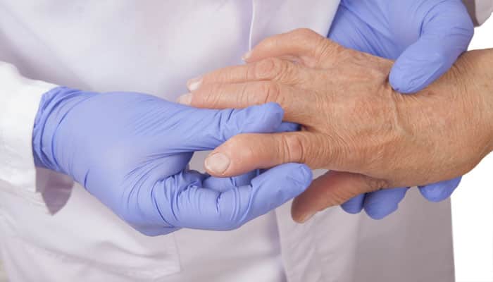 Hormonal changes during menopause could worsen arthritis symptoms: Study