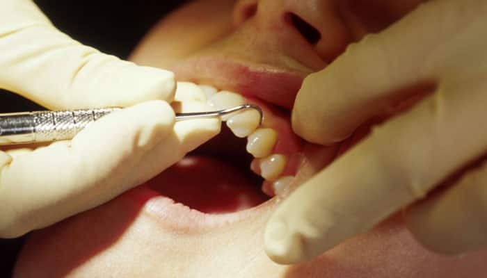 New &#039;smart&#039; material to help fight tooth decay