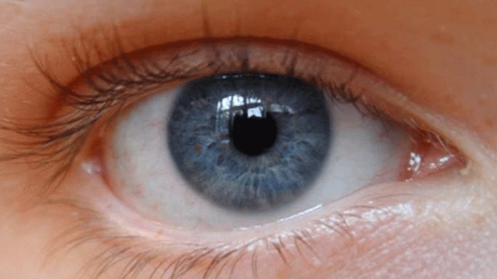 US FDA approves first AI device to detect diabetic eye disease