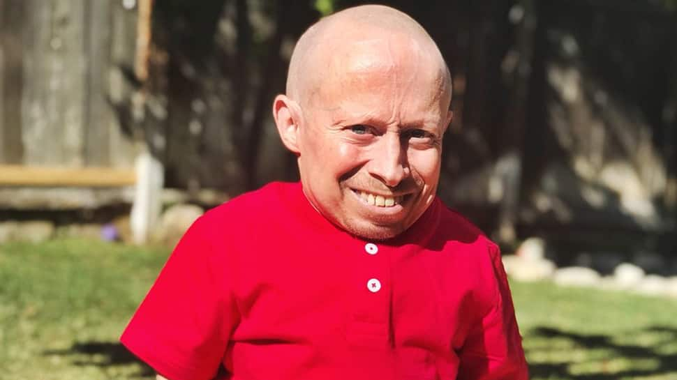 &#039;Austin Powers&#039; fame Mini-me dead at 49