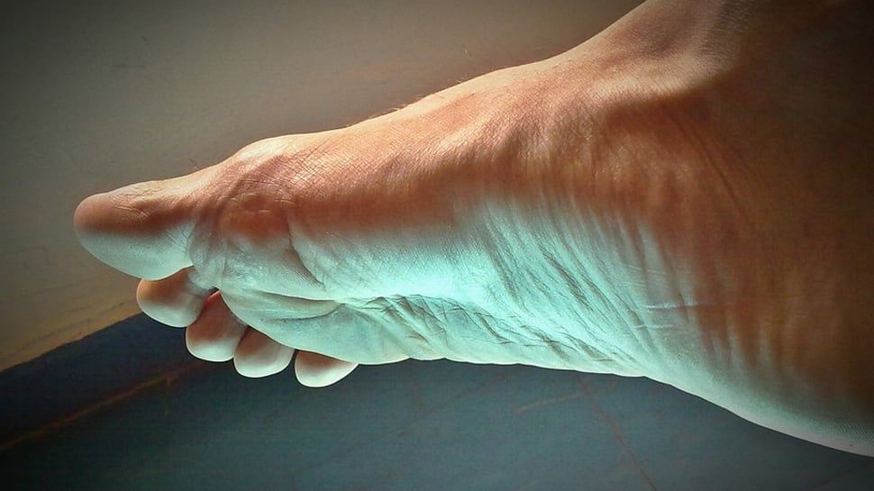 Shocking! Man claims to have fed his amputated foot to friends as tacos