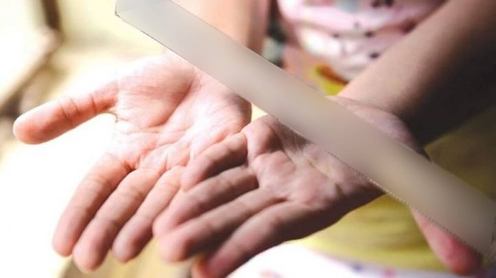 Angry over bed-wetting, step-mother brands 7-year-old girl with hot spatula