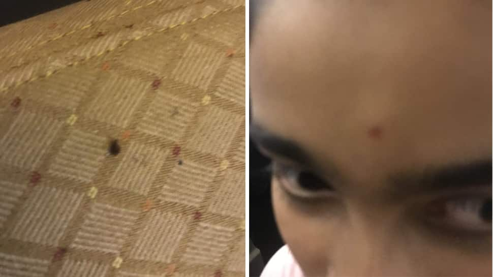 Passengers post photos of bed bugs on Air India flight from the US, airline calls it an &#039;isolated&#039; case