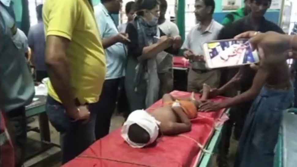 West Bengal: 3-year-old receives bullet injuries on head during clashes in Malda