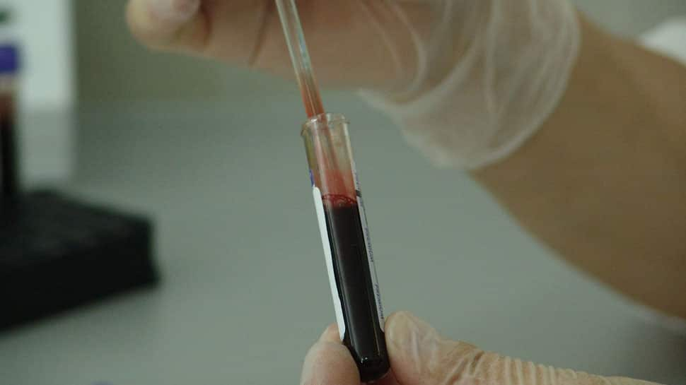 New blood test to screen for secondary heart attack: Scientists 