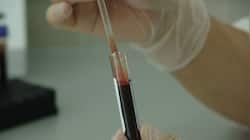 Lakhimpur Kheri: Health dept on alert after man tests positive for swine flu