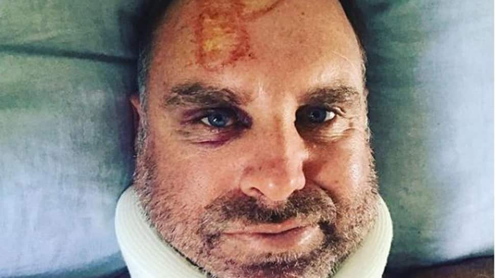 Former Australian cricketer Matthew Hayden fractures neck in surfing accident