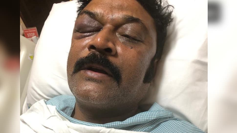 Karnataka brawl row: Congress MLA files FIR against party MLA Ganesh for assaulting him