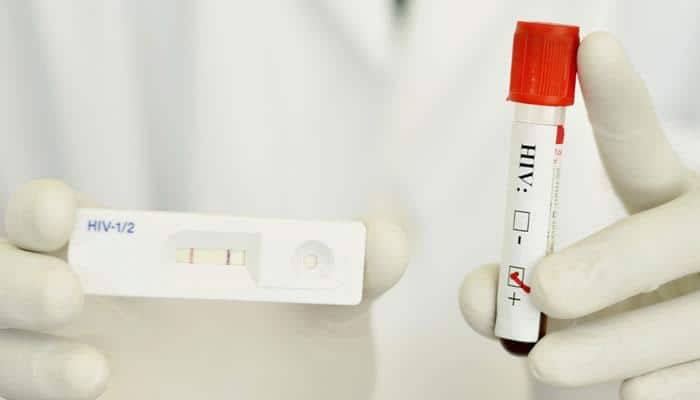 Scientists develop tool to measure success of HIV cure strategies
