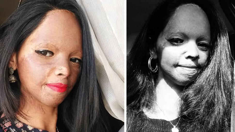 People finding beauty in an acid-burnt face: Laxmi Agarwal