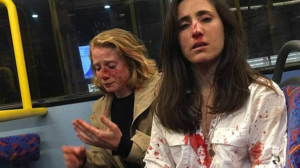 Two women beaten, robbed by gang of men in UK &#039;for refusing to kiss&#039;