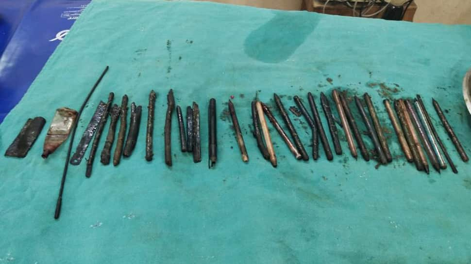 Blade, wire and pen among 33 sharp objects taken out of man’s stomach during surgery