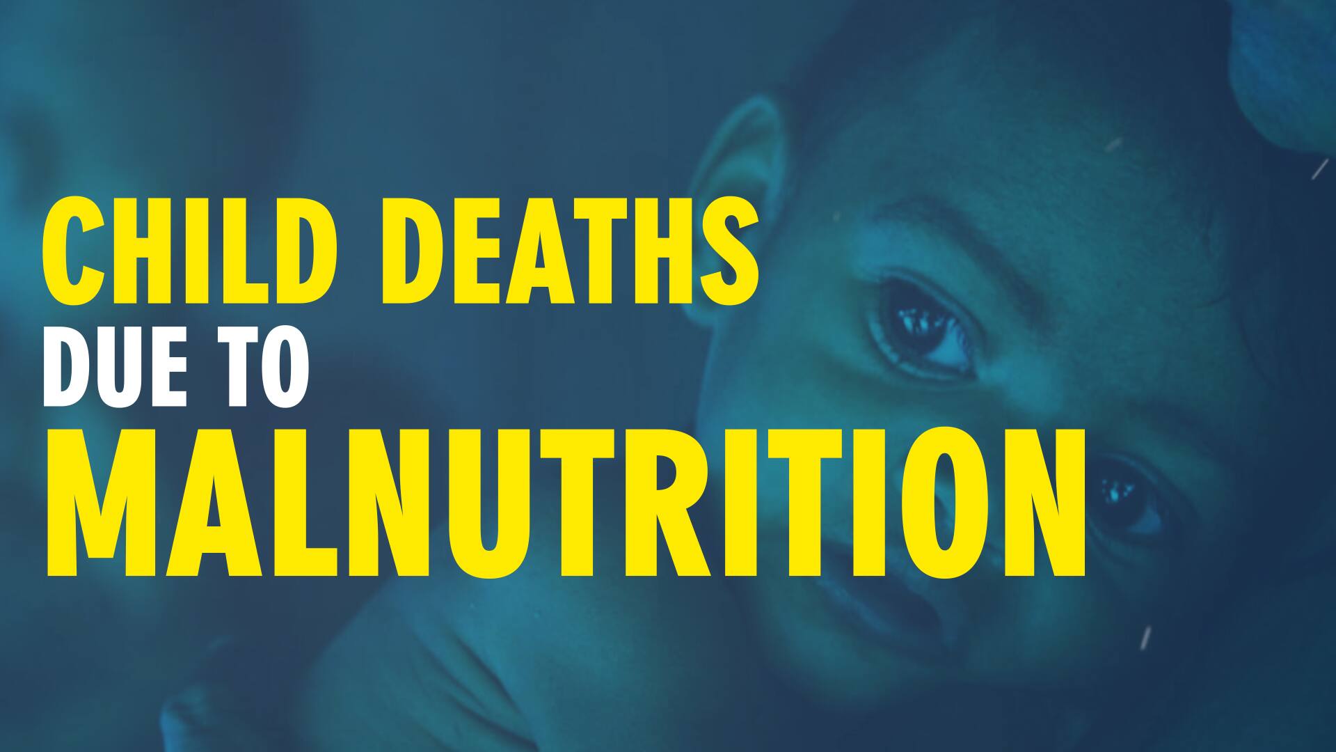 68 per cent of under 5 child deaths attributed to Malnutrition: Report ...
