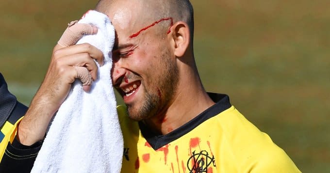 Ashton Agar left bloodied after dropping brother Wes&#039; catch during Marsh Cup