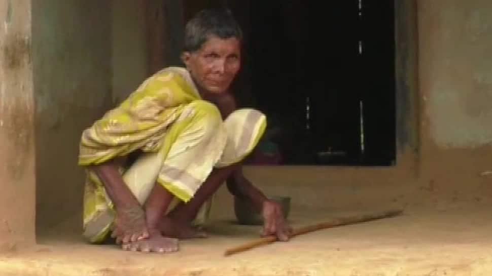 Odisha: Woman born with 20 toes, 12 fingers, branded a witch, forced to stay indoors