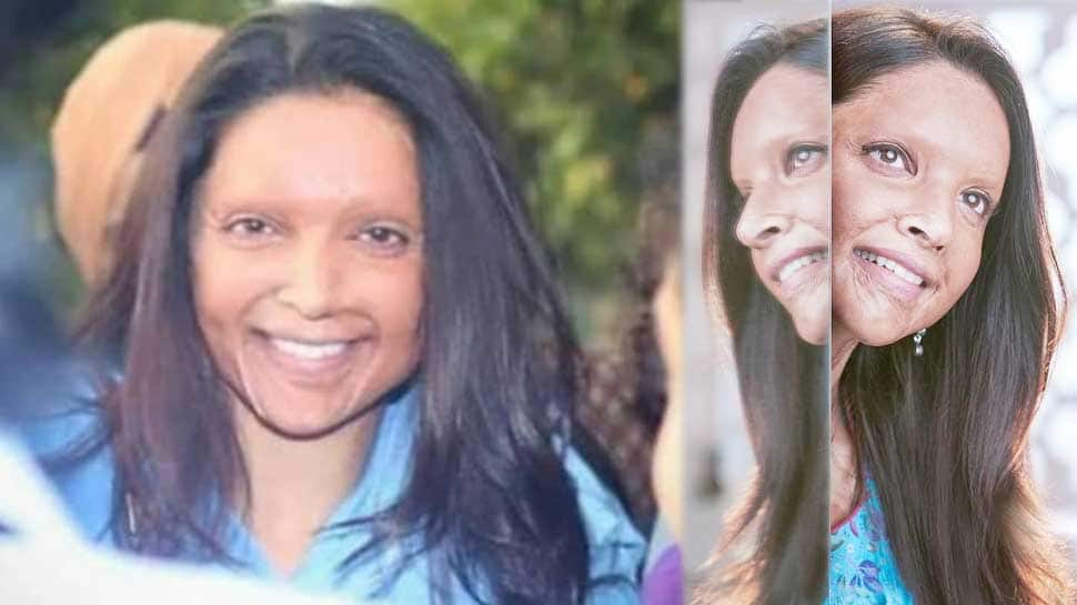 Rangoli Chandel reacts to Deepika Paudukone&#039;s Chhapaak trailer 