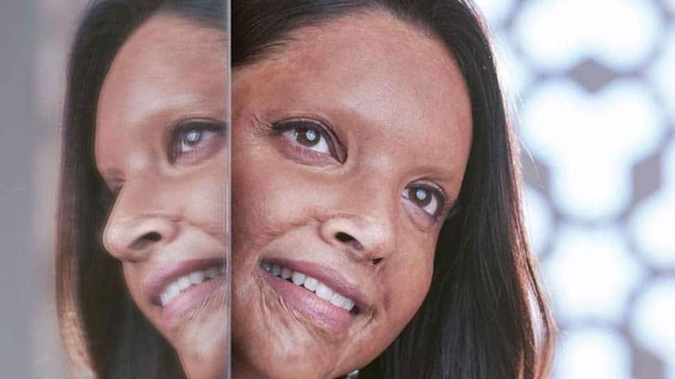 English activist Katie Piper praises Deepika Padukone's 'Chhapaak'