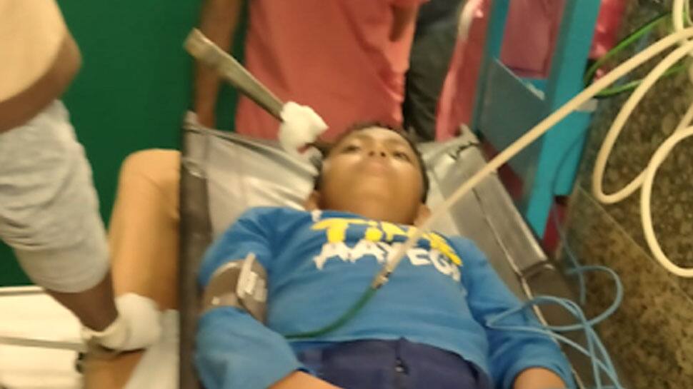 West Bengal: Boy with javelin injury to head, successfully operated on