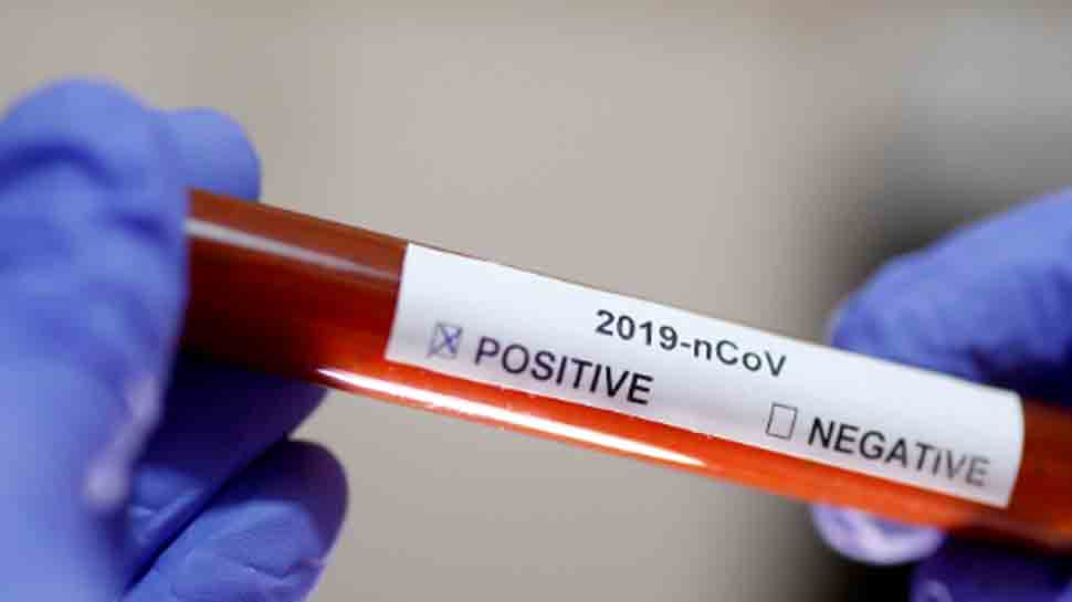 18,084 people screened for coronavirus at Mumbai international airport till February 8