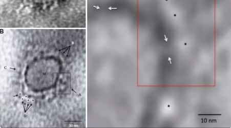 Indian scientists reveal images of SARS-CoV-2 virus causing COVID-19