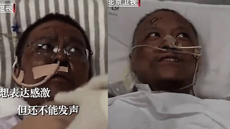 Critically ill with COVID-19, Chinese doctors wake up to find darkened skins, damaged liver