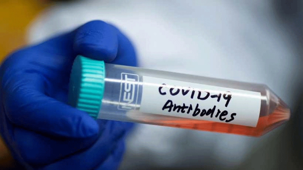 ICMR issues advisory on Antigen detection test for COVID-19