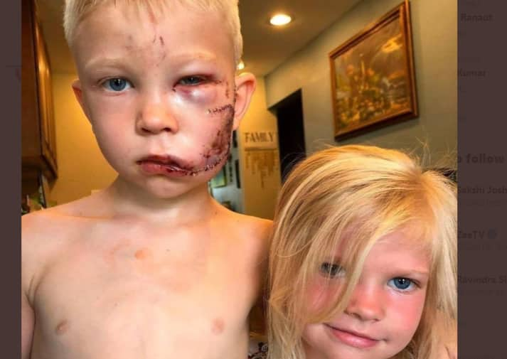 6-year-old Bridger Walker gets global praise for saving little sister from dog attack