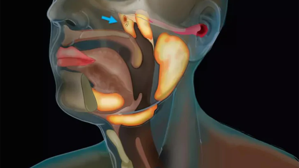 Researchers find new organ in throat that may help in treatment of cancer - Details here