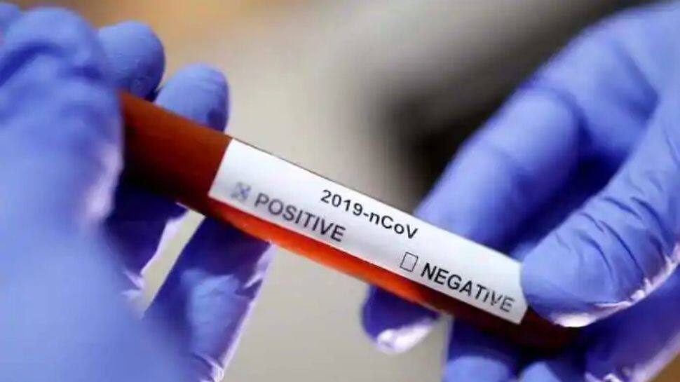 Karnataka mandates negative COVID-19 RT-PCR report for people arriving from Maharashtra