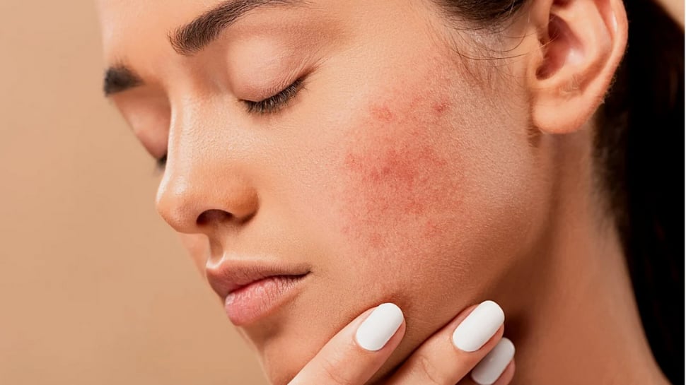 These skin problems can indicate a serious underlying health issues