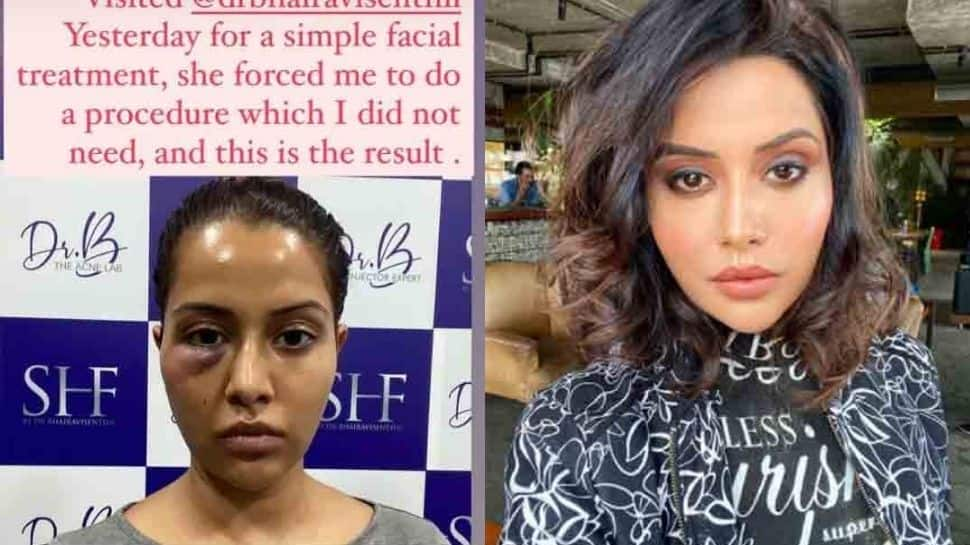 Tamil actress Raiza Wilson slaps legal notice on dermatologist after wrongful cosmetic procedure, seeks 1 cr compensation