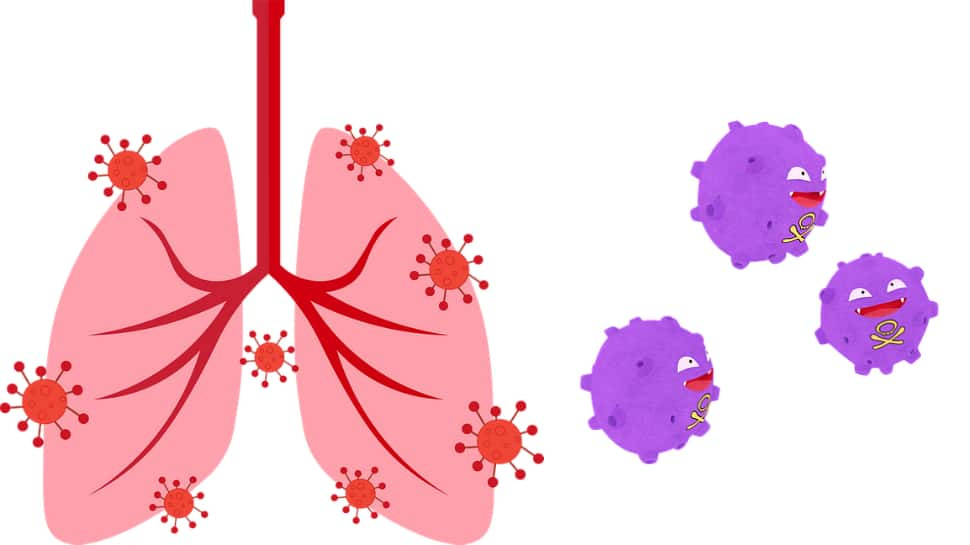  COVID-19: How the virus can affect your lungs