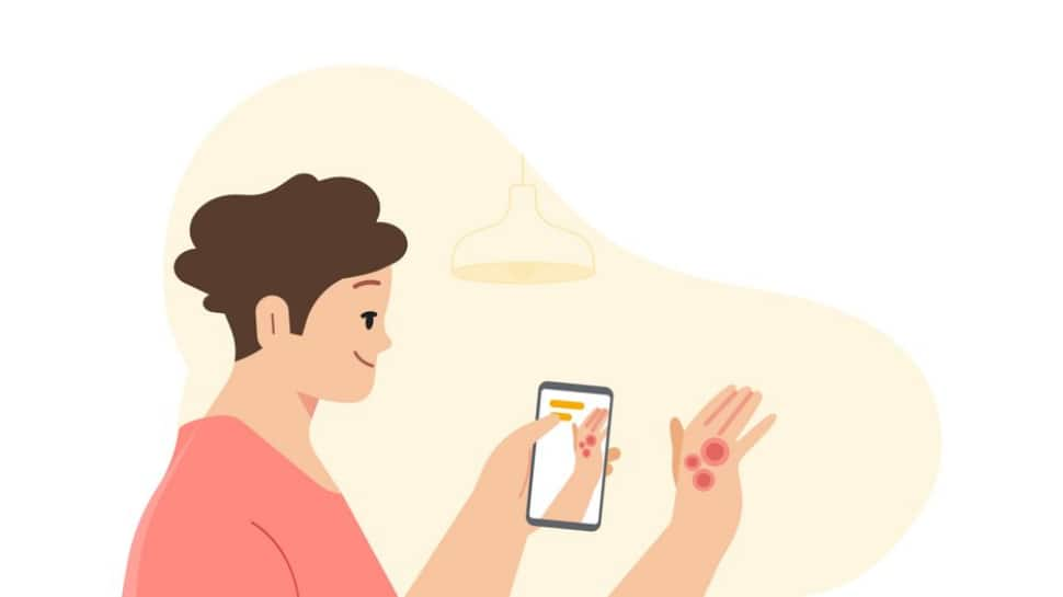 Google update! Use your smartphone to identify skin conditions at home