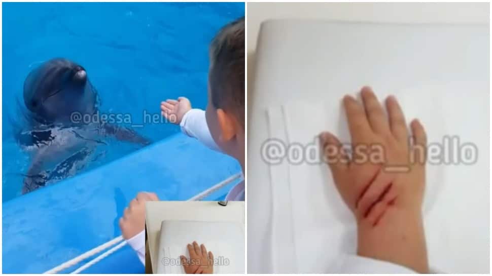 Terrifying! Dolphin bites little kid&#039;s hand, little boy gets three stitches 