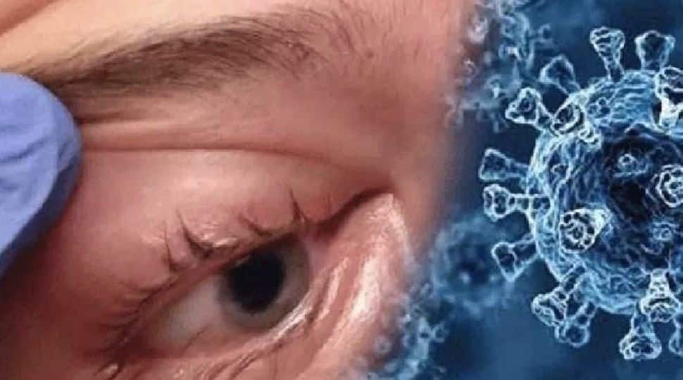 First ever case of &#039;Optic Neuritis&#039; after black fungus; Kanpur authorities on alert