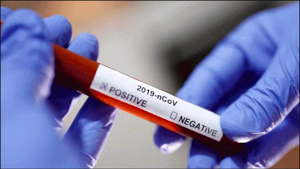 UK lifts quarantine for fully vaccinated EU, US travellers