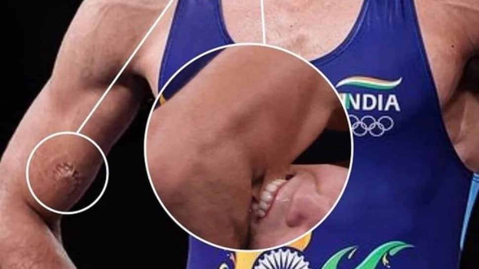 Tokyo Olympics Wrestling: Ravi Kumar Dahiya brutally bitten during semis bout - WATCH 