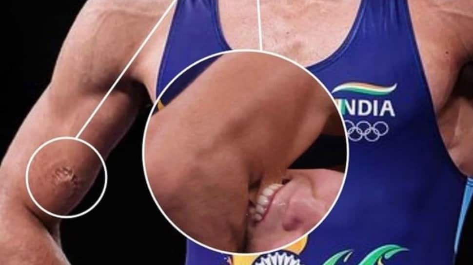 Tokyo Olympics: Furious Virender Sehwag says THIS about Ravi Dahiya ‘biting’ incident