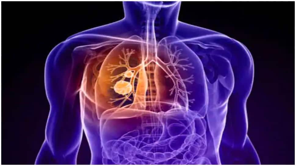 Short-lived lung infection may cause permanent lung damage, here's why