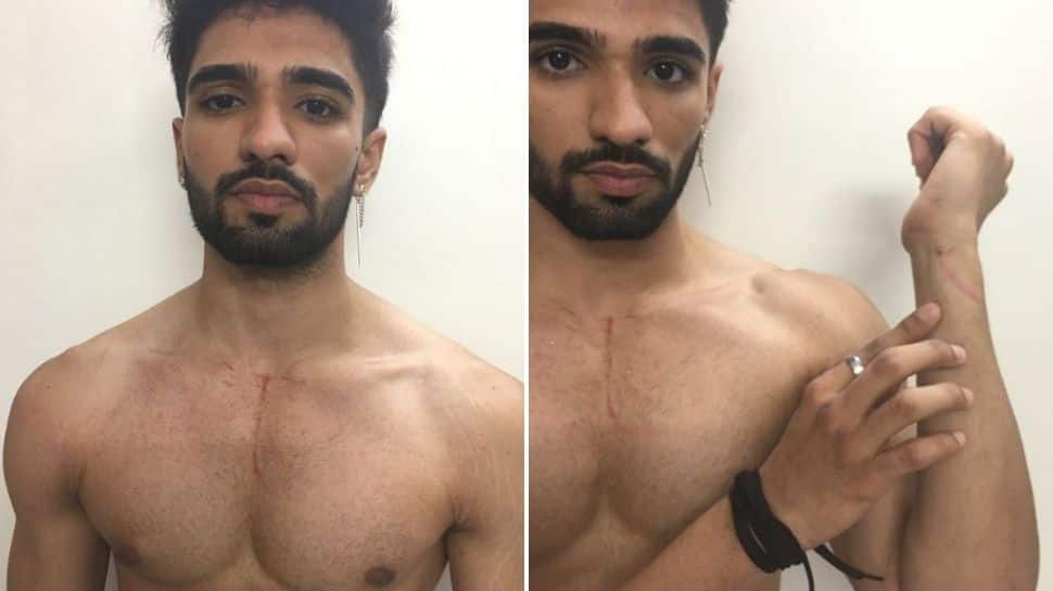Bigg Boss OTT: Zeeshan Khan shares shocking pictures of scratch marks after his eviction!